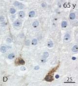 DCX-expressing cells in a 65 year-old hippocampus