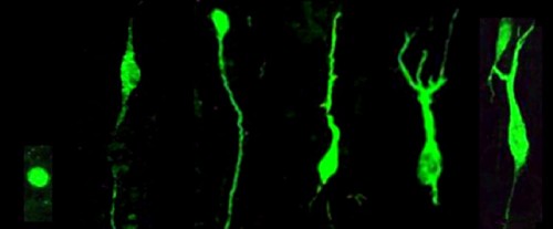 Morphology of DCX+ cells observed by Knoth et al., ranging from immature (left) to mature (right)