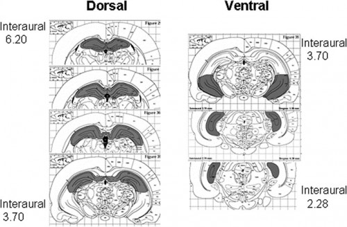 Banasr dorsal vs ventral