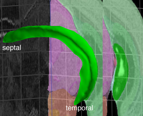 This section is even more caudal yet the dentate granule cells (white patches within bright green region) are more dorsal than in the previous section. So, more caudal doesn't necessarily mean more ventral.