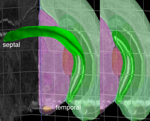 The dentate gyrus is shown in bright green in this relatively caudal section. This section contains ventral dentate gyrus (at the bottom, by "temporal") but, at the top of the section, it also contains a portion of the dentate gyrus that as dorsal as any other part of the dentate gyrus, despite being far from the septal pole.